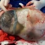 baby-en-caul-birth