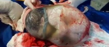 baby-en-caul-birth