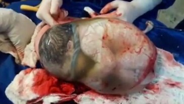 baby-en-caul-birth