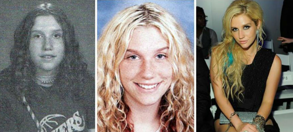 celebs-puberty-and-now-08