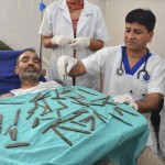 stomach-knives-india