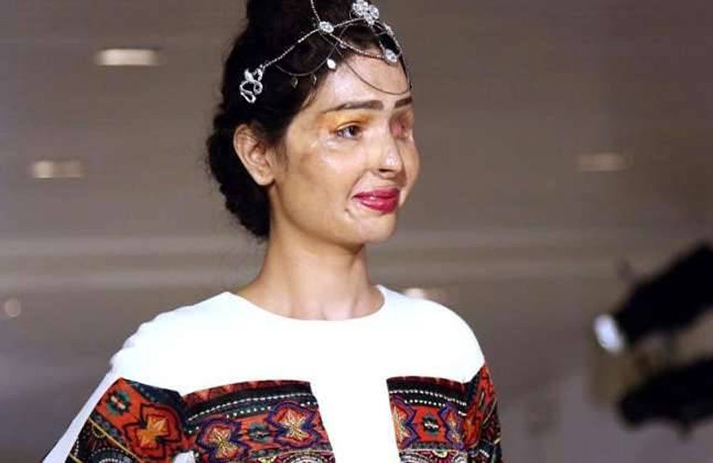 acid survivor