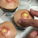 pimple-cupcake