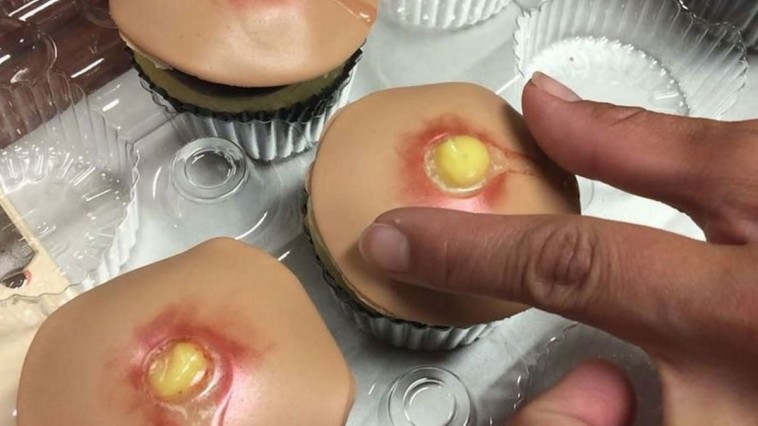 pimple-cupcake