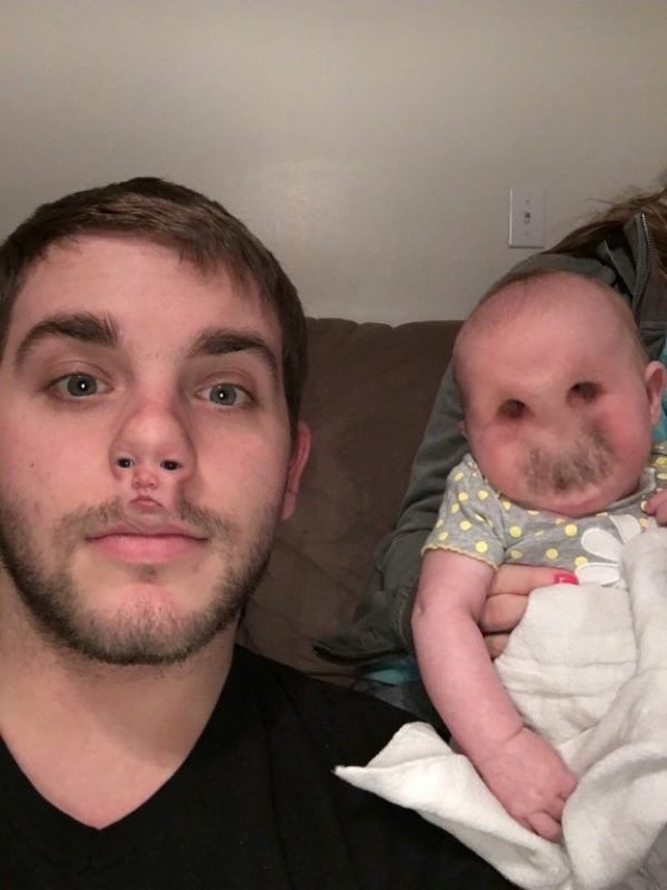 snapchat