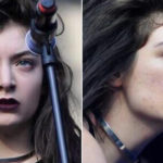 Lorde acne