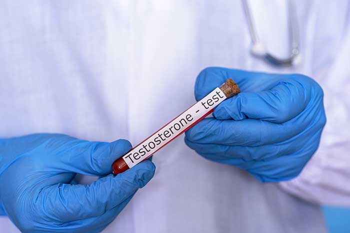 What Men Need To Know About Testosterone Replacement Therapy