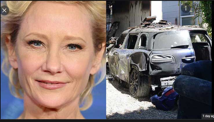 Actress Anne Heche Sets a Home on Fire after Fatal Crash; In Critical Care at ICU