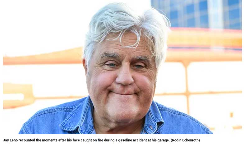 Jay Leno Breaks Ribs, Collarbone, and Kneecaps after Fatal Motorcycle Accident