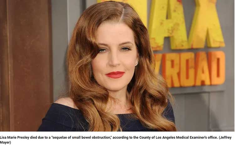 Lisa Marie Presley Died of Bowel Obstruction and Natural Causes